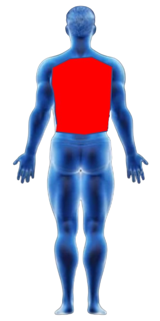 Back Pain