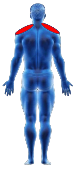 Shoulder Pain