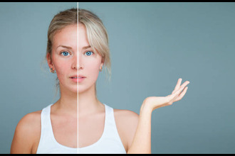 Skin Disorder