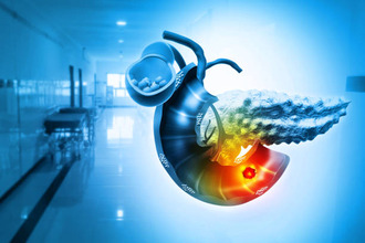 Pancreatitis